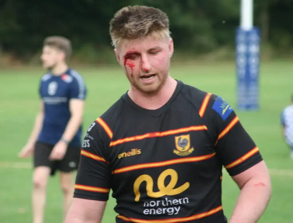 Harrogate Pythons Rugby Union Football Club